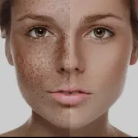 با تیرگی ها و لک های بدن خداحافظی کنید