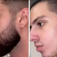 ریش نداری کلیک کن