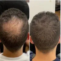 ریش و پشمتو با تضمین در بیار
