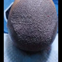 کاشت مو فقط در یک روز با ضمانت تراکم|خدمات آرایشگری و زیبایی|اصفهان, کشاورزی|دیوار