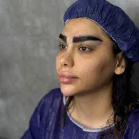 مدل کاشت ابرو طبیعی