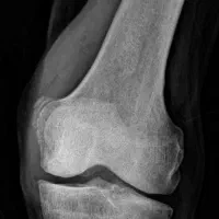 رادیولوژی و سونوگرافی در منزل تهران و کرج|پزشکی|تهران, ونک|دیوار