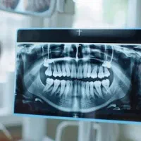 اگر امروز به دندانهایت توجه نکنی فردا دیره|خدمات آرایشگری و زیبایی|رفسنجان, |دیوار