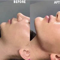 جشنواره ویژه ژل لب،کانتورینگ صورت|خدمات آرایشگری و زیبایی|تهران, شهرک غرب|دیوار