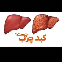 درمان کبد چرب|خدمات آرایشگری و زیبایی|گنبد کاووس, |دیوار