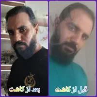 پیوند مو و ابرو در تهران در کلینیک معتبر|خدمات آرایشگری و زیبایی|کاشان, امیرکبیر|دیوار