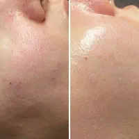 مدل برای تکمیل آلبوم لاین تخصصی پوست|خدمات زیبایی و سلامت|کرج, مهرویلا جنوبی|دیوار