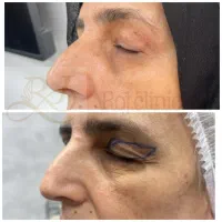 تخفیف مشاوره خدمات زیبایی وجراحی صورت  بدن|خدمات آرایشگری و زیبایی|تهران, میدان ولیعصر|دیوار