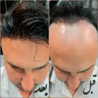 فقط توی یک ساعت صاحب موی طبیعی بشو