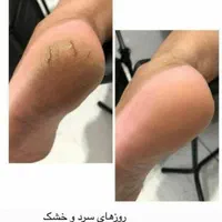 آموزش و خدمات پرسینگ و پدیکورتراپی تخفیف ۸۰ درصدی|خدمات آرایشگری و زیبایی|کرج, باغستان|دیوار