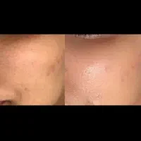 جشنواره فیشیال و پاکسازی و کلیه امور پوست و مو|خدمات آرایشگری و زیبایی|فردیس, فردیس|دیوار