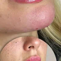 تخصص ما لیزر ژل و بوتاکس حرفه ای و جوانسازی پوست|خدمات آرایشگری و زیبایی|تهران, شهرک ولیعصر جنوبی|دیوار