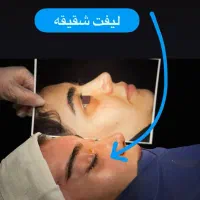 جشنواره بلفارو پلاستی پلک فقط 8500|خدمات آرایشگری و زیبایی|اصفهان, بهار آزادی|دیوار