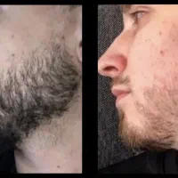 اگر ریشه داری ولی ریش نداری بیا