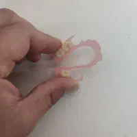 ساخت انواع دندان های مصنوعی متحرک و لثه ژله ای