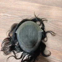 پروتز مو وارداتی