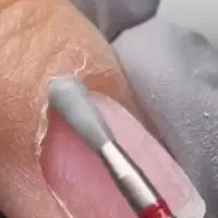 کاشت وترمیم ناخن