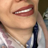 لمینت بدون تراش/کمترین قیمت/بالاترین کیفیت|خدمات آرایشگری و زیبایی|اصفهان, پروین|دیوار