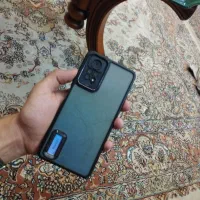 ردمی نوت 11 پرو
