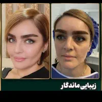 آموزش جراحی صورت کاشت ابرو بلفاروپلاسی ساکشن غبغب|خدمات آموزشی|اصفهان, خواجو|دیوار