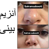آنزیم بینی گوشتی غبغب پلاسما تراپی|خدمات آرایشگری و زیبایی|شیراز, محراب|دیوار