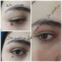 پوست ،زیبایی|خدمات آرایشگری و زیبایی|رباط‌کریم, الارد|دیوار