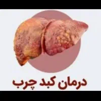 درمان کبد چرب