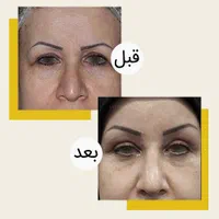 همه جراحی های زیبایی باشرایط اقساط و وام بدون ضامن|خدمات آرایشگری و زیبایی|تهران, فلسطین (میدان انقلاب)|دیوار