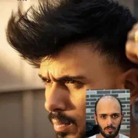 پروتز مو ( وارداتی - با ضمانت Vip )