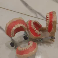 دو عدد تایپودنت(فک تمرینی)