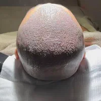 کاشت مو ابرو ریش تارکوب|خدمات آرایشگری و زیبایی|ورامین, |دیوار