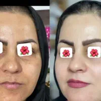 کرم ضد لک چند کاره