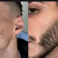 این اقدام اخریشهه