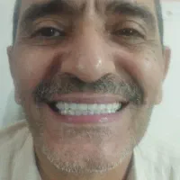 دندان سازی دندان مصنوعی یک روزه یزدی با ضمانت