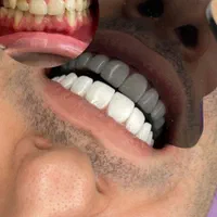 اموزش کامپوزیت ۱۰ میلیون|خدمات آموزشی|تهران, ترمینال غرب|دیوار