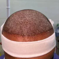 جشنواره ۷ ملیونی کاشت مو /بانوان و اقایان|خدمات آرایشگری و زیبایی|شیراز, قصرالدشت|دیوار