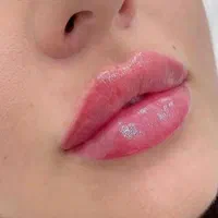 تزریق ژل بوتاکس لیزر هایفو مزو پی ار پی نخ فیشیال|خدمات آرایشگری و زیبایی|شهریار, |دیوار