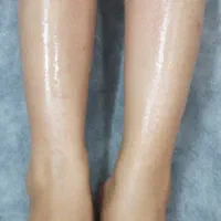 اپیلاسیون دائم ولیفت مژه و ابرو باموادمای لمینیشن