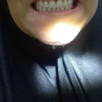 ساخت دندان مصنوعی با بهترین کیفیت