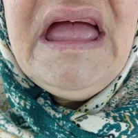 لابراتوار دندان سازی سلامت|خدمات آرایشگری و زیبایی|نیشابور, شریعتی|دیوار