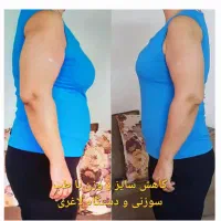 طب سوزنی، بوتاکس، آموزش، مزوتراپی، پلاسماتراپی|خدمات آرایشگری و زیبایی|مشهد, حسابی جنوبی (شهرک غرب)|دیوار
