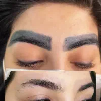 لیزرپاک کردن تتو ابرو تتو بدن با جدید ترین دستگاه