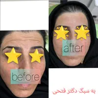 انجام کلیه خدمات زیبایی توسط پزشک در کلینیک در فسا|خدمات آرایشگری و زیبایی|فسا, |دیوار