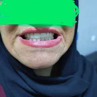لابراتوار دندان مصنوعی|خدمات آرایشگری و زیبایی|جم, |دیوار