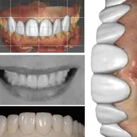 استخدام و اموزش طراحی دندان اگزوکد دندانسازی