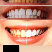 پروتز دندان (دندان مصنوعی)|خدمات آرایشگری و زیبایی|تربت‌حیدریه, بازار|دیوار