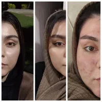 فشیال تخصصی ( تو تابستون پوستتون روشن کن)