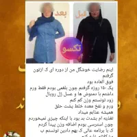 لاغری اصولی|آرایشی، بهداشتی، درمانی|کوهدشت, |دیوار