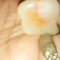 عقیق خونی مصور، سلطانی گبری، مهره بجول، طلا|جواهرات|تهران, هلال احمر|دیوار