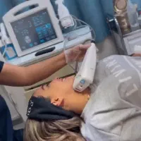 دستگاه هایفو ۴ هندپیس